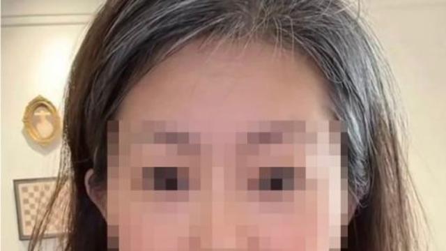 절친·남편 불륜 배신감에…하룻밤 새 '백발' 됐다는 여성