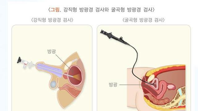 [안치영의 메디컬와치] ‘요도 타들어가는 통증’ 막으면 나쁜 의사인가요