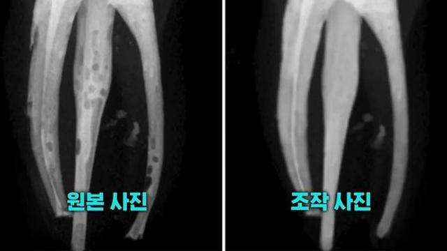 예비 치과의사들, 단체로 AI 이용해 실습 엑스레이사진 조작