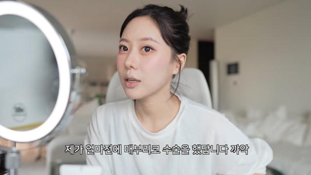 '환승연애' 고민영, 코 성형수술 고백…