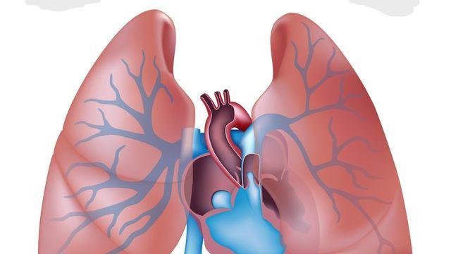 숨 가쁨과 피로, 단순 노화일까?... 침묵의 살인마 ‘폐고혈압’ 주목해야