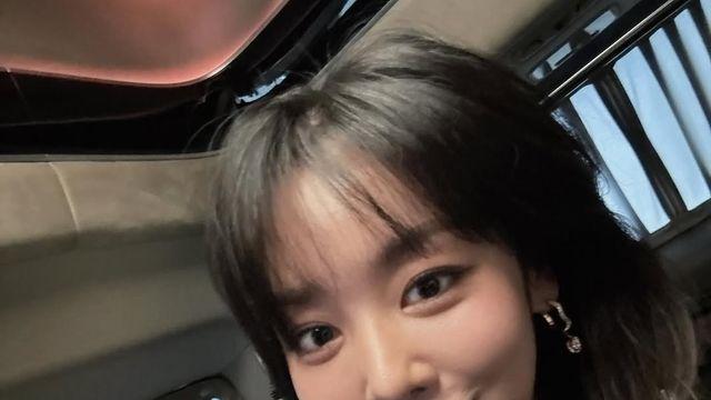 배우 차주영, 비출혈 증상으로 수술 