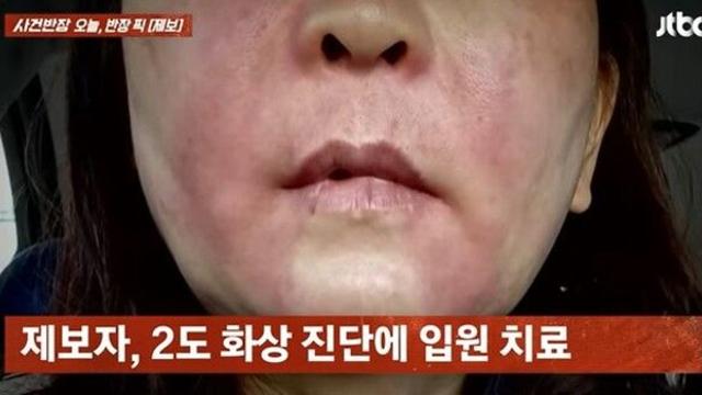 마트 직원 따라 실로 묶어 구웠다가…곱창 폭발로 화상