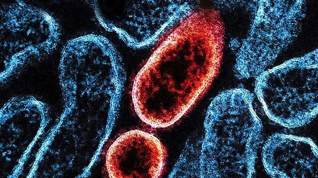 '니파 바이러스'란 무엇인가?