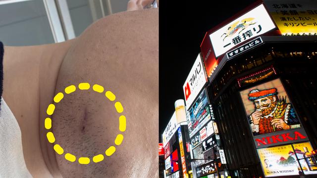 [단독] “앞니 3개 부러지고 피범벅” 韓관광객 日서 집단폭행 당해