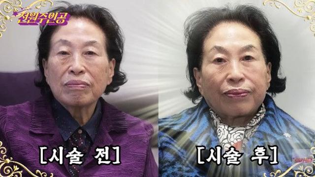 전원주, 500만 원 피부과 시술 후 '완벽 변신'…