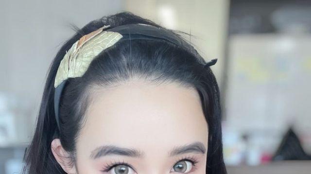 박봄, 건강 호전된 근황... 얼굴 절반이 눈이야 [IS하이컷]