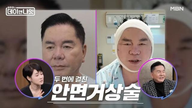 심형래 안면거상→김준호 안검하수 수술 전후 사진 공개 (데이앤나잇)