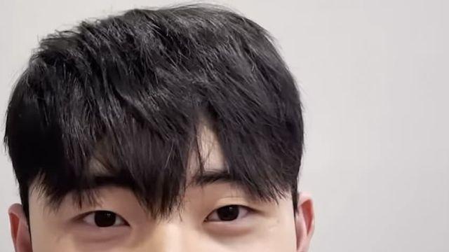 성형하고 잘생겨진 남자들의 변화 과정.jpg