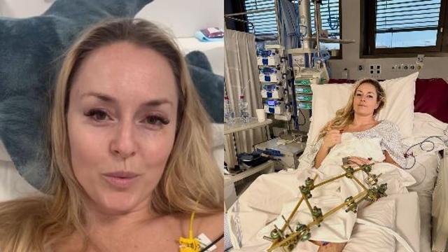 이럴 수가! 다리 절단 가능성이라니… '스키 여제' 린지 본, 4번째 수술한다 