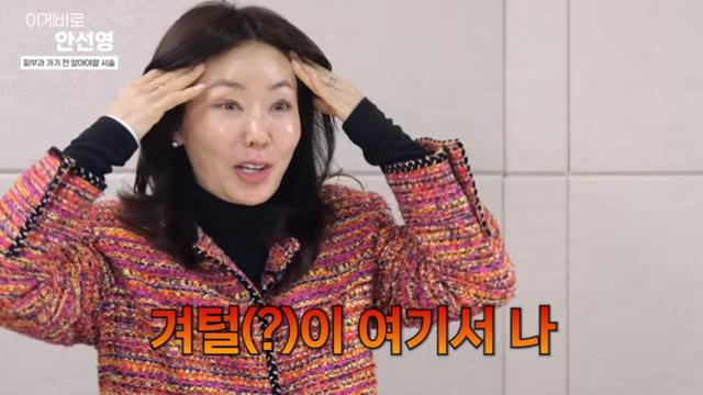 '49세' 안선영, 결혼식 앞두고 '모발이식' 부작용 고백…