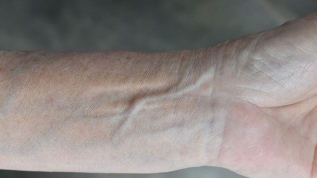 '도대체 왜 그런가 봤더니..' 몸속에 흐르는 피는 분명 빨간색인데, 겉으로 보이는 혈관은 파랗게 보이는 이유