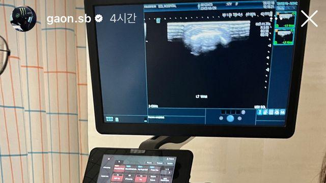 투혼의 금메달 거머쥔 최가온, SNS에 “3군데 골절” [밀라노올림픽]