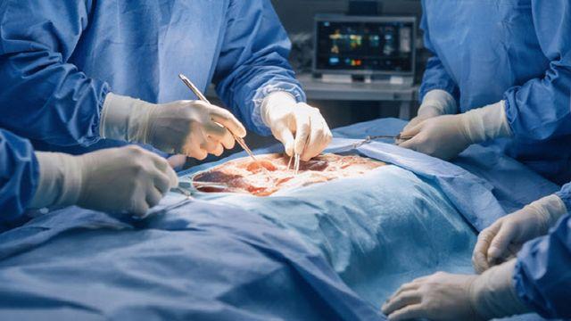 담낭암 진단에 간 일부도 절제했지만…병원 