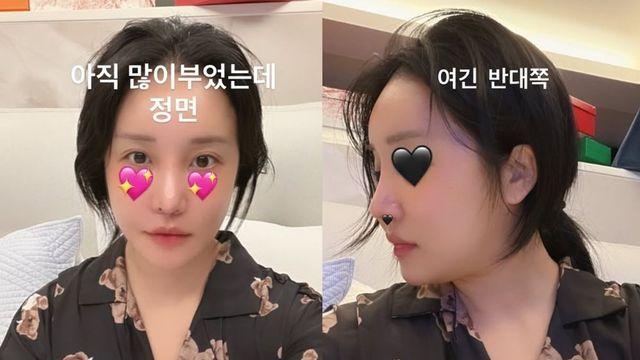 랄랄, 성형 후 다른 사람 됐다.. 정석미녀 그 자체 [RE:스타]