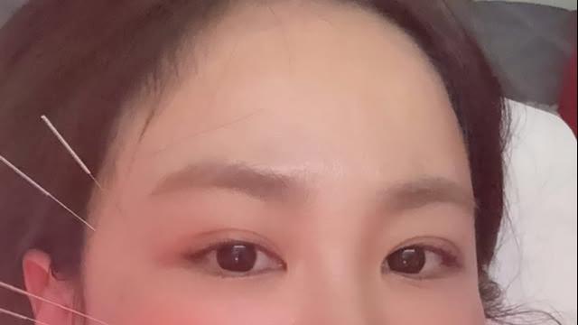 ‘♥김준호’ 김지민, 2세 준비 중 얼굴 함몰…“돌아오겠죠?”