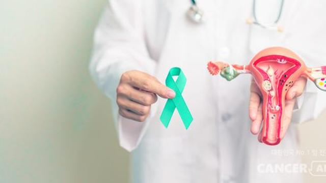 PARP억제제에 내성 생긴 재발성 난소암, 베바시주맙 병용투여 효과