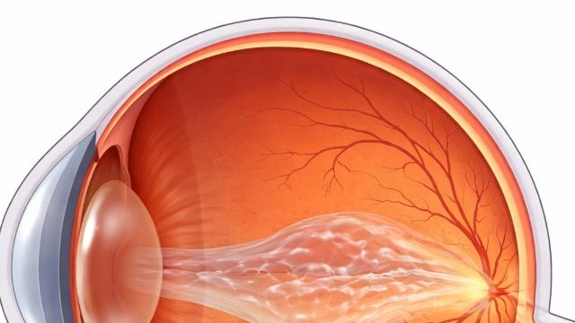 [위클리 건강] 잠 부족이 눈 섬유화 촉진…