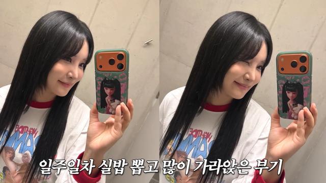 랄랄, 코 재수술 3번 만에 대만족…