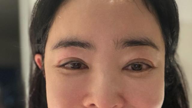 ‘폐암 수술’ 이혜영, 림프부종 나아진 근황 “목표는 회복” [IS하이컷]