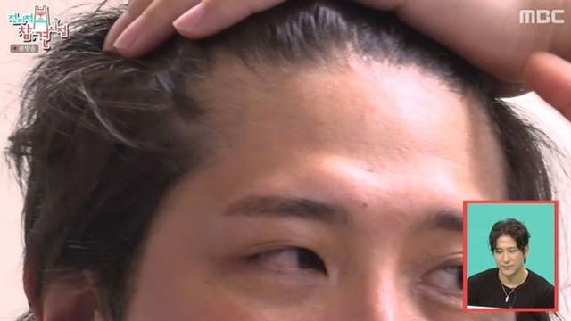 황재균, 탈모 진단→”또 결혼해야 할까요?” 고민 폭로에 ‘당황’ (‘전참시’)