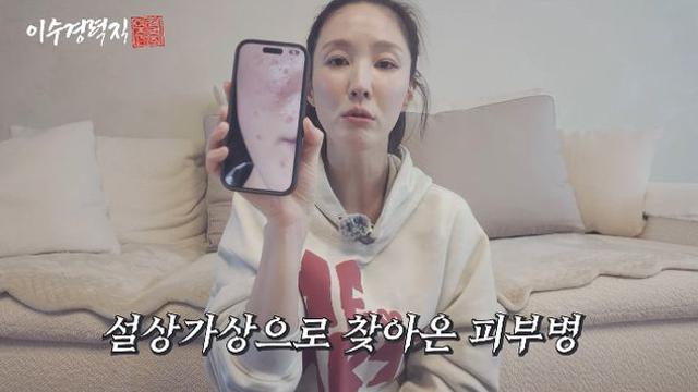 이수경, 창업 실패로 원인 모를 피부병 앓아…