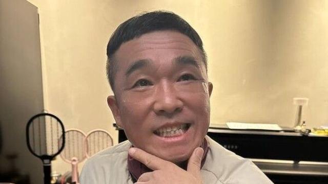 김건모, 이윤미의 '테이프 시술'로 동안 변신… 주영훈과 함께 전한 유쾌한 근황