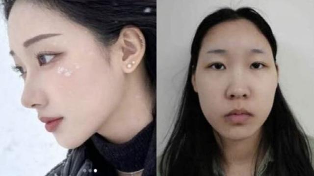 '약물 연쇄살인' 김소영, 추가 송치… 피해자 2명 모발서 '동일 약물'