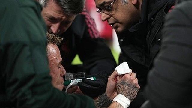 '피 철철' 손가락 잘릴 뻔, 심각한 부상+산소 공급까지…조롱하던 팬들도 경악 