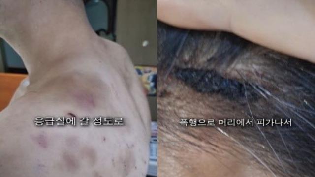 “도망치면 가족 살해”…직원 감금하고 폭행한 부산 중식당