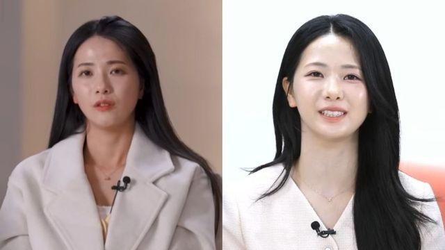 30기 영자, '눈밑지' 2주만 확 달라진 얼굴…