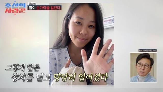 인순이 딸, 급후진 차량에 손가락 절단 