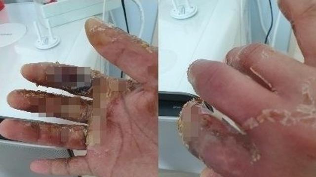 thumbimg
