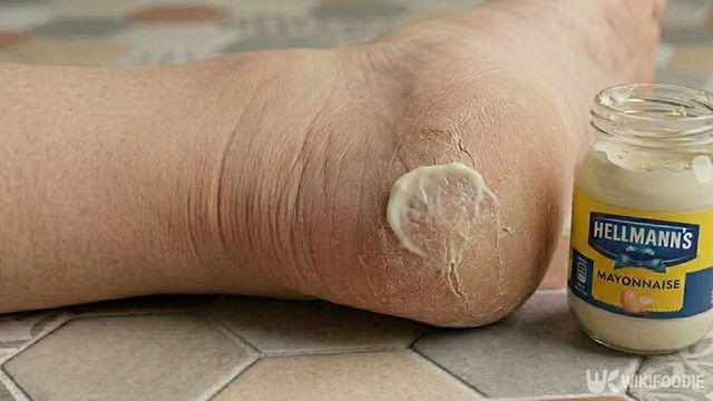 thumbimg