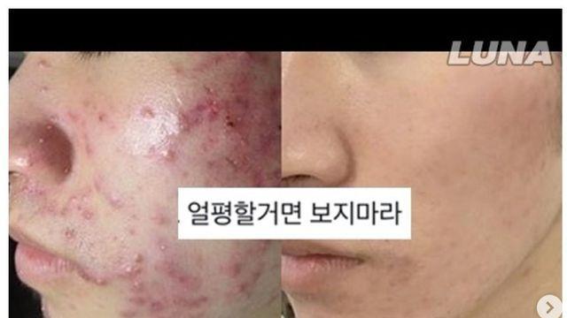 13년 곰보빵이 사람된 썰