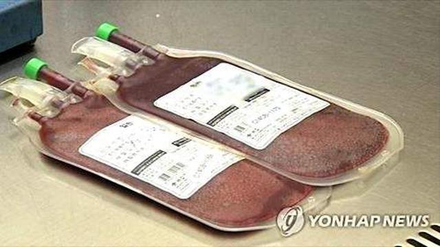 복수 기증자 유래 줄기세포 병용 치료, 혈액암 환자 생존율 획기적 개선