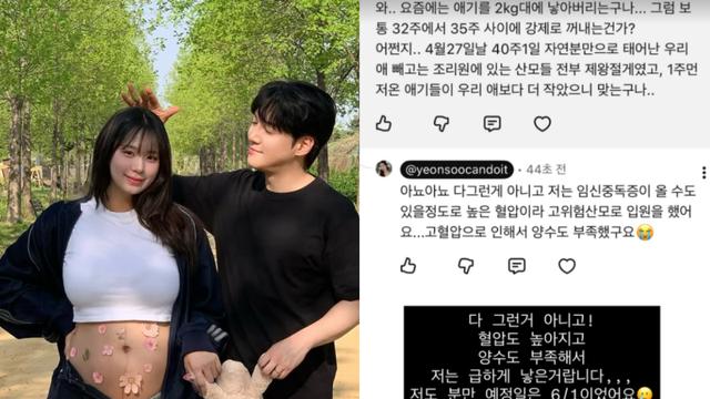 ‘최현석 딸’ 최연수 “아기 2kg대에 강제로 꺼냈다고?” 조기출산 해명