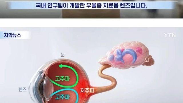 상상도 못한 국내 우울증 치료제 개발 근황