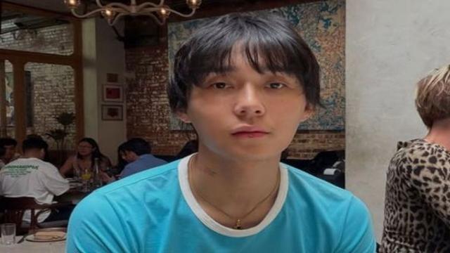 던, 만성부신증후군 고백하며 근황 전했다