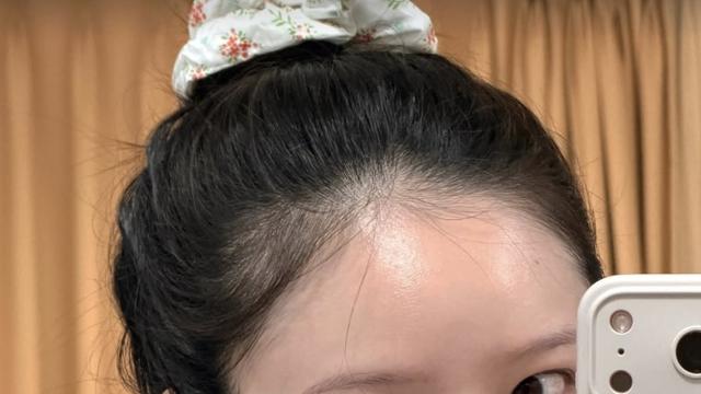 ‘사업가♥’ 김지영, 출산 6일만 7kg 감량…”내 몸에 무슨 일이” [IS하이컷]