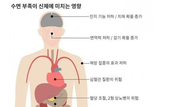 수면 부족이 신체에 미치는 영향