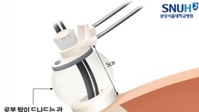 국내 최초 다기관 연구 ‘소아 단일공 로봇수술’ 초기 안전성 및 시행 가능성 확인