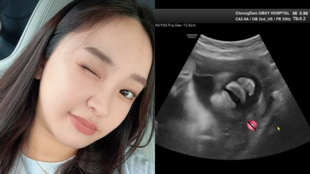 ‘아이돌 출신’ 나현, 출산 앞두고 2세 공개…“입술 귀여워” [IS하이컷]