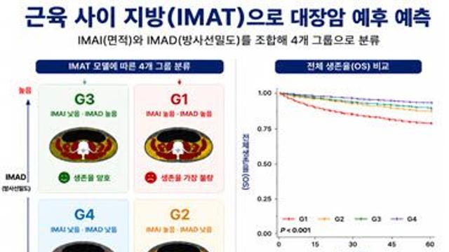 대장암 생존율, ‘근육 사이 지방’이 가른다
