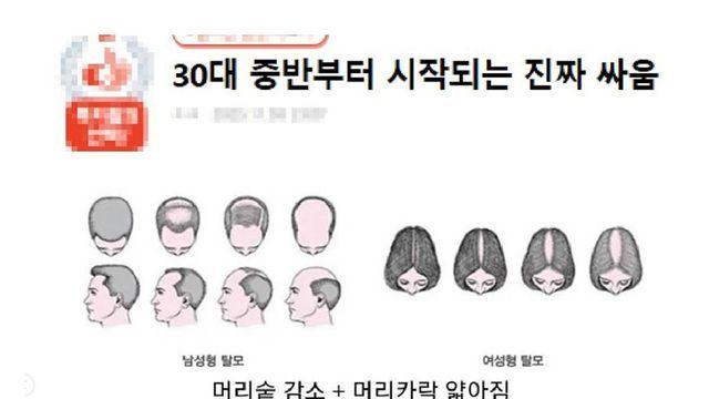 30대 중반부터 시작되는 찐 싸움