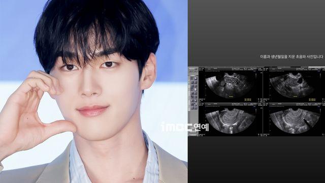 홍민기 전 여친, 진료내역서·초음파 사진 공개 [소셜in]