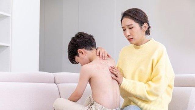“크면 괜찮아지겠지”…소아 아토피, 기다림보다 중요한 ’적기 치료‘