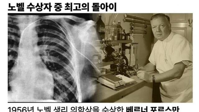 노벨 수상자 중 최고의 돌아이