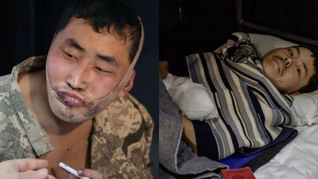 우크라 북한군 포로 2명 귀순 수순?…젤렌스키 “한국 보냈다”, 정부도 사실상 시인