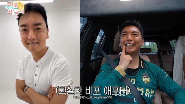 곽범, ‘고정 8개’ 될만했네 “얼굴에만 수천만원 들여” (‘전참시’)